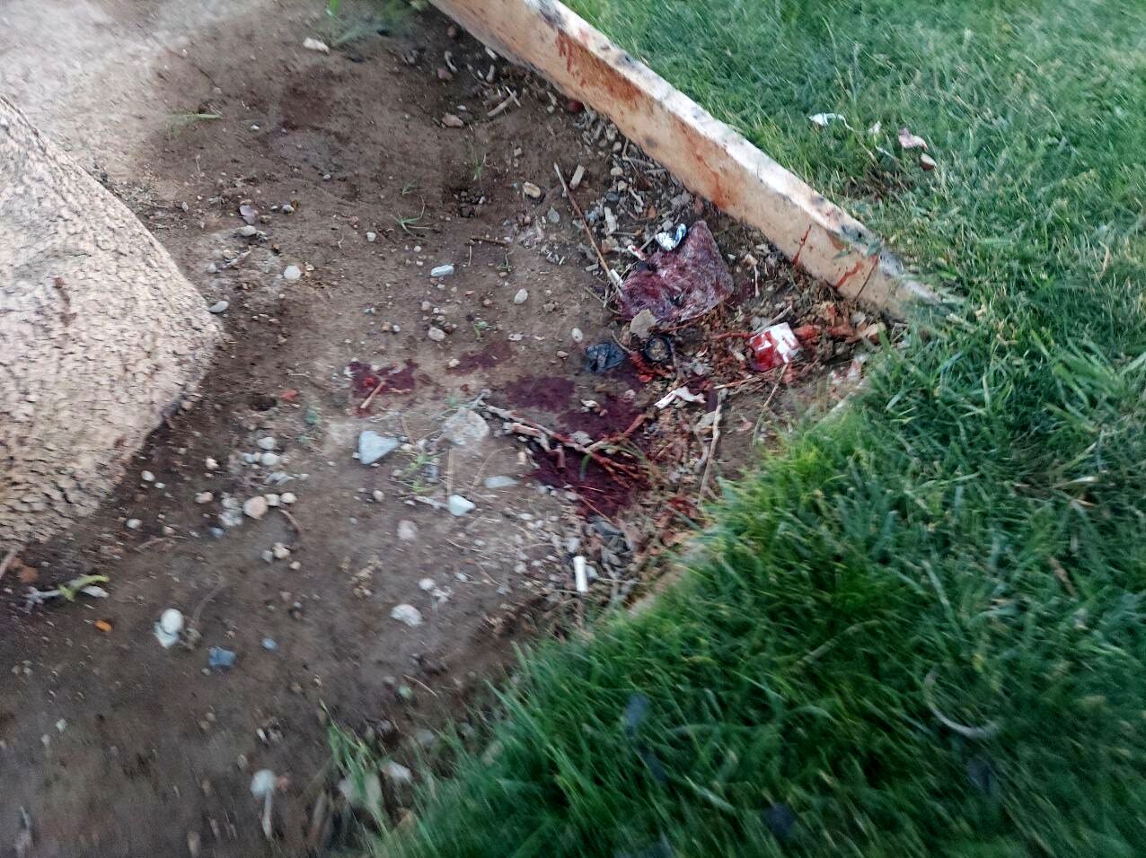 تصاویر | جسد تکه تکه شده زن جوان در میدان آزادی تهران | ساک مشکوکی که مامور شهرداری پیدا کرد | ۴ ساعت از جنایت می‌گذشت ...