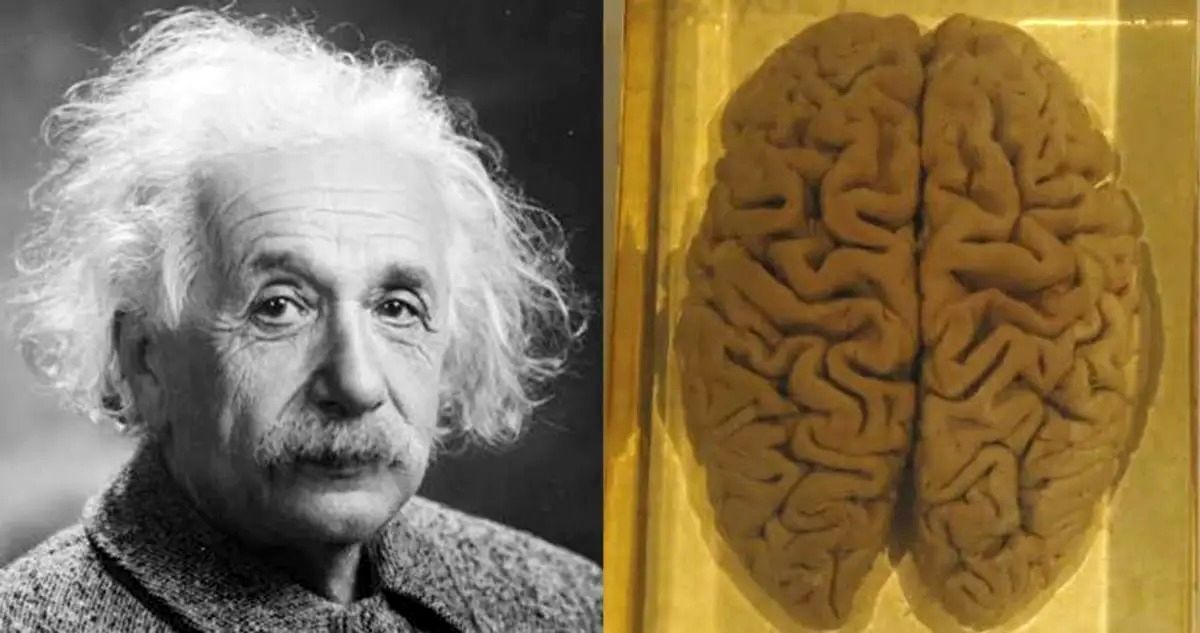 عکسی از مغز آلبرت اینشتین در داخل شیشه 2