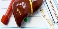  راه‌های درمان فوری کبد چرب