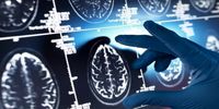 با این داروی گیاهی به جنگ آلزایمر بروید