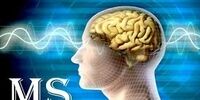 8 اقدام برای کاهش خطر ابتلا به بیماری ام اس