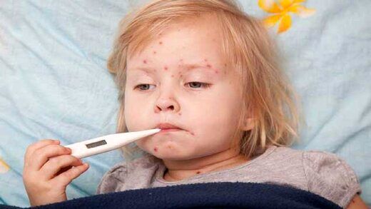 هشدار؛ افزایش سرخک در کشور / لزوم واکسیناسیون کودکان