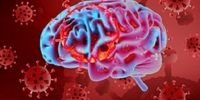 آیا کرونا ویروس خطر بروز سکته مغزی را افزایش می دهد؟

