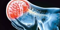 برای مقابله با سکته مغزی چه کارهایی باید کرد؟