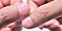 چند باور غلط پزشکی، اما شایع در زندگی روزمره