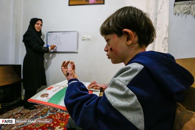 بیماری ای بی