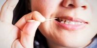مضرات استفاده از خلال دندان