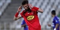تغییر باورنکردنی چهره بازیکن پرسپولیس بعد از عمل زیبایی+ عکس
