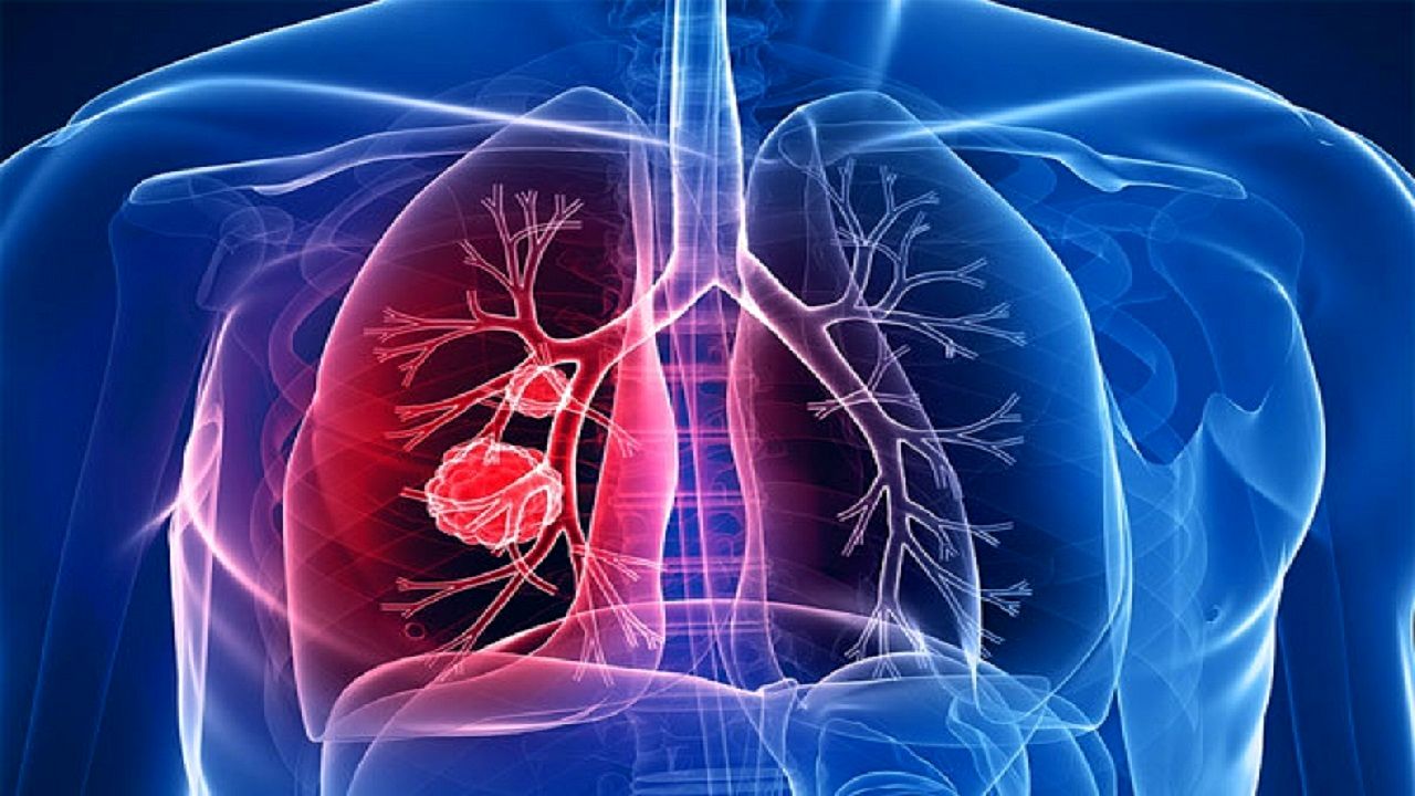 ۶ نشانه که ریه‌های‌تان نیازمند پاکسازی است


