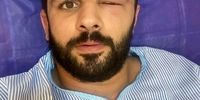 بستری شدن عضو تیم ملی کشتی آزاد ایران در بیمارستان