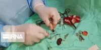 خارج کردن گلوله تفنگ پس از ۳۸ سال از بدن جانباز جهرمی + عکس