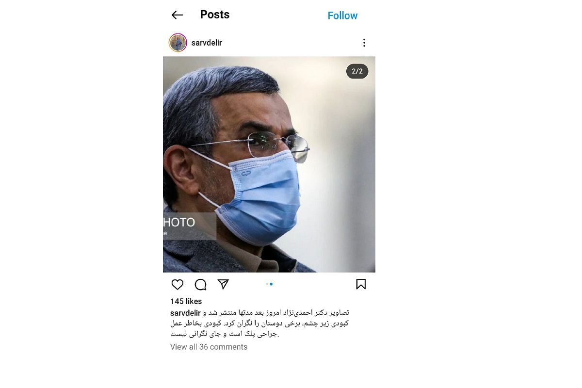 علت تغییر چهره احمدی نژاد مشخص شد+ عکس 