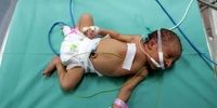 فاجعه در غزه/مرگ غم‌انگیز 2 نوزاد شیرخوار