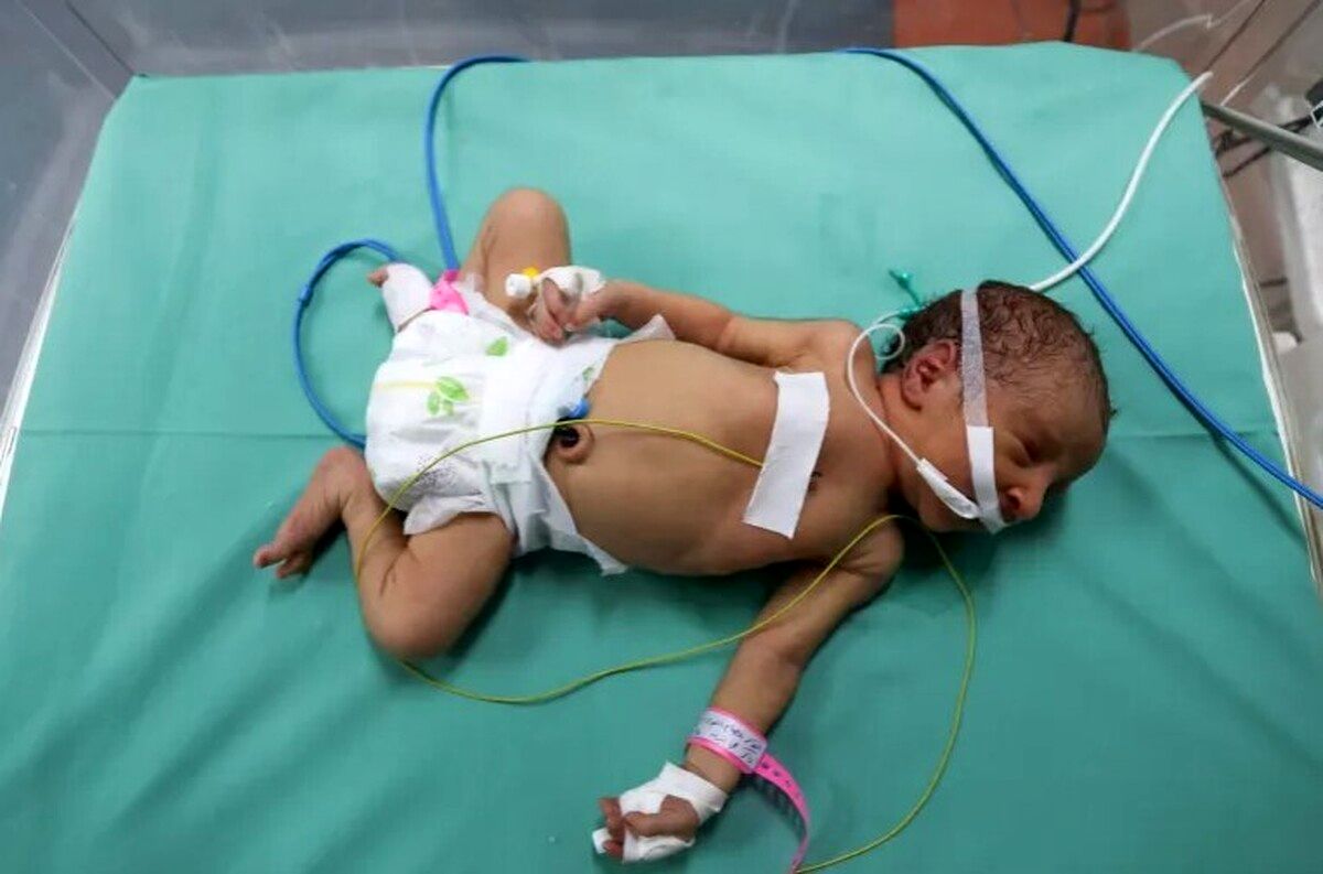 فاجعه در غزه/مرگ غم‌انگیز 2 نوزاد شیرخوار