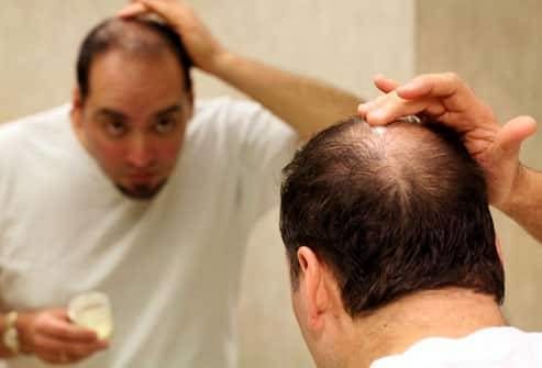 اثبات وجود رابطه مستقیم بین میزان ساعت کاری با ریزش موی سر!