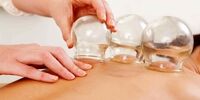 این افراد به هیچ وجه نباید حجامت کنند
