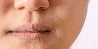 این افراد می توانند در کودکی پیر شوند