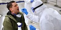 کشف عجیب‌ترین علائم ابتلا به کرونا

