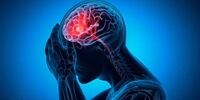 نشانه‌های مهم سکته مغزی را بشناسید

