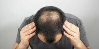 بهترین راه بازگشت موهای از دست رفته چیست