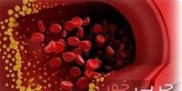 اگر چربی خون بالایی دارید؛ حتما این توصیه ها را بخوانید!