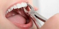 از دست دادن دندان عقل این حس شما را چند برابر می کند
