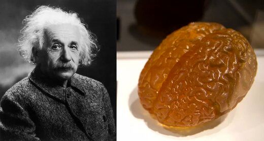 یک حقیقت عجیب و باورنکردنی درباره مغز انیشتین+عکس