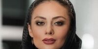 چهره عجیب یکتا ناصر پس از انجام جراحی زیبایی+ عکس
