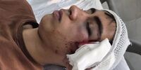 ضرب‌وشتم دانش‌آموز بمی با دسته صندلی توسط معلم/ آموزش‌وپرورش: کرامت انسانی خط قرمز ماست