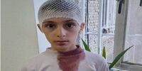 حکم جالب قاضی برای معلمی که سر دانش آموزش را شکست!