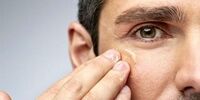 کرونا چه بلایی بر سر پوست و موی شما می‌آورد؟