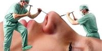 ریشه اقتصادی هجوم پزشکان به جراحی زیبایی | مجوزهایی که براساس رفاقت و روابط صادر می شود