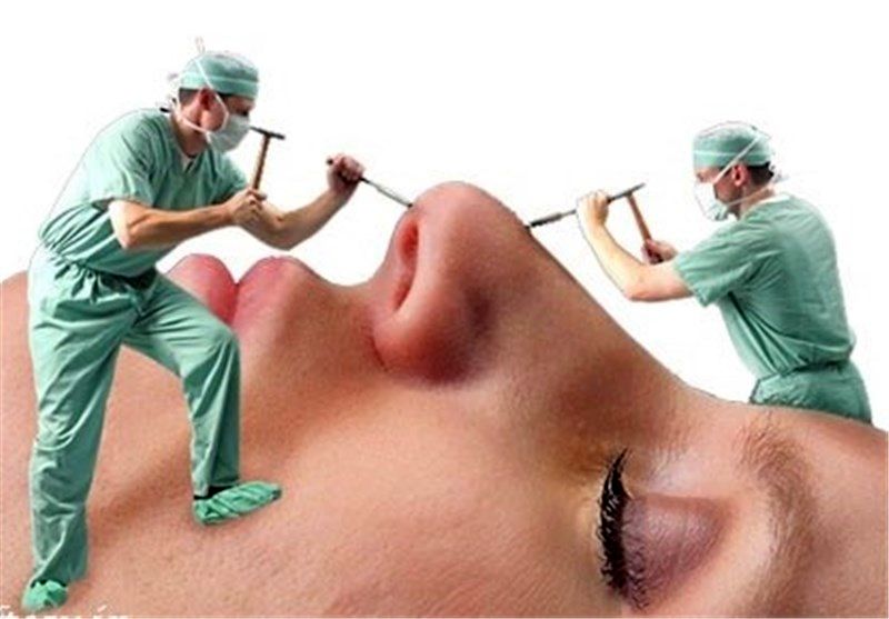 ریشه اقتصادی هجوم پزشکان به جراحی زیبایی | مجوزهایی که براساس رفاقت و روابط صادر می شود 2