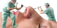هیچ بینی‌‌ ایده‌آلی در جهان وجود ندارد