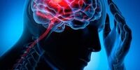  افزایش خطر سکته مغزی با این کار