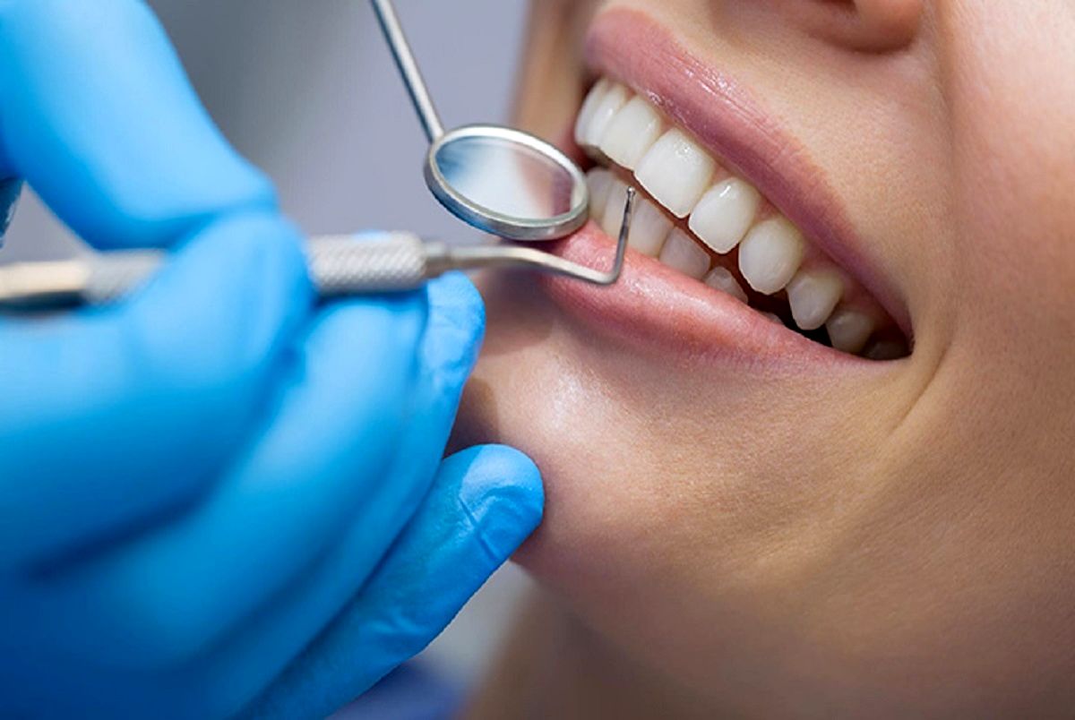 تعرفه جدید دندانپزشکی 1401 اعلام شد + جزئیات