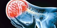 پشت میزنشینی خطر سکته مغزی را ۷ برابر بیشتر می‌کند