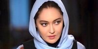 شکستن جمجمه نیکی کریمی موقع فیلمبرداری!
