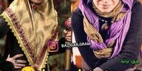 بازیگران مشهوری که مبتلا به بیماری خاص هستند+تصاویر