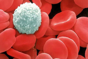 اثر شگرف ویتامین C بر سلول های سرطان خون