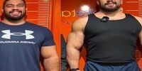 افزایش 17 سانتی متری قد با عمل جراحی!

