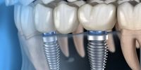 با گران ترین خدمات یک کلینیک دندانپزشکی آشنا شوید