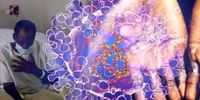 ویروس ام‌پاکس؛ هراس تازه جهان از اپیدمی جدید+ علائم