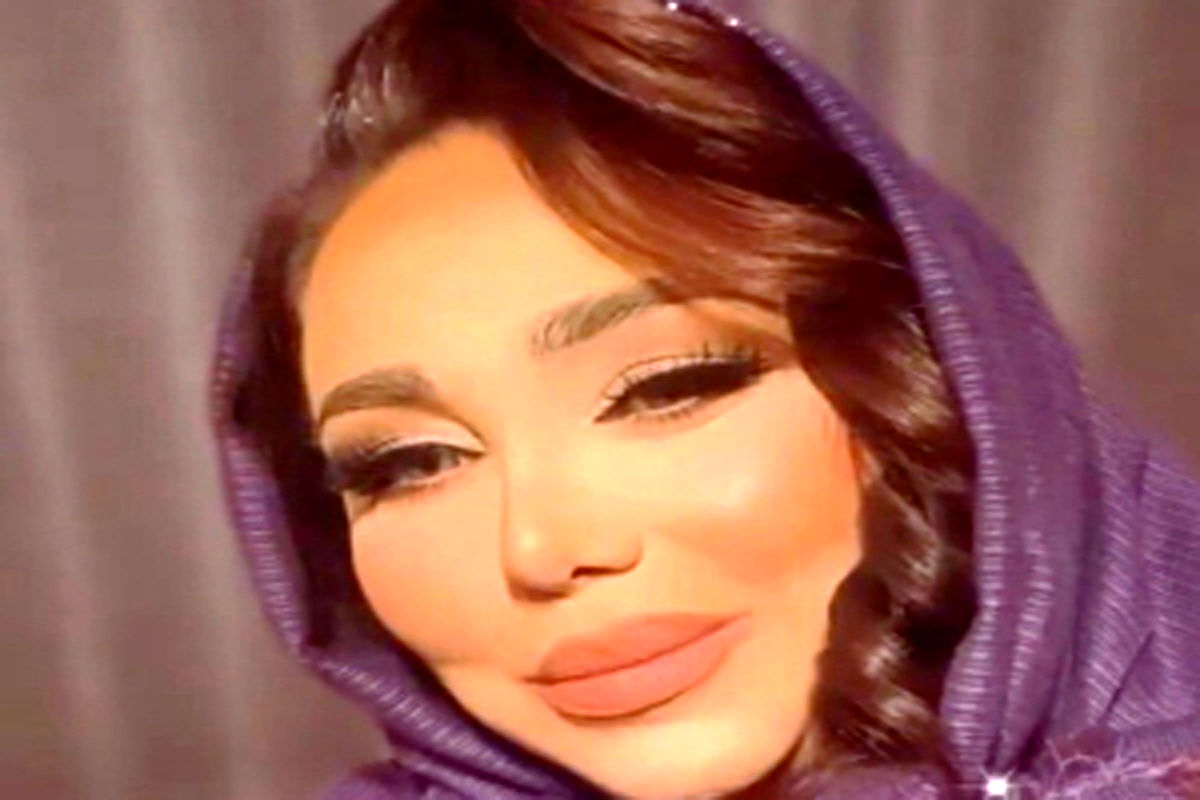 چهره متفاوت بهنوش بختیاری قبل از عمل زیبایی