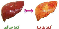 ۴ تغییر پوستی که نشان می‌دهد کبد بیماری دارید
