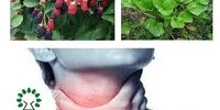 این گیاهان دارویی بر التهاب گلو اثربخش‌اند
