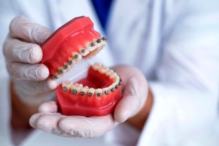 قبل از ارتودنسی دندان بخوانید