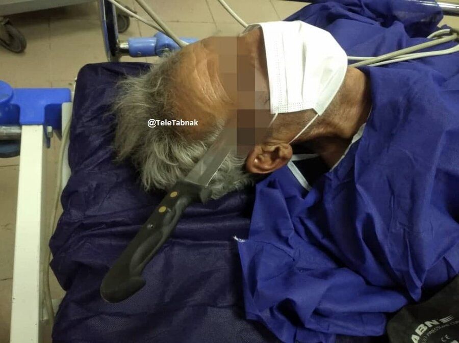  خارج کردن چاقو از جمجمه پیرمرد 50 ساله در بیمارستان لقمان+ تصاویر