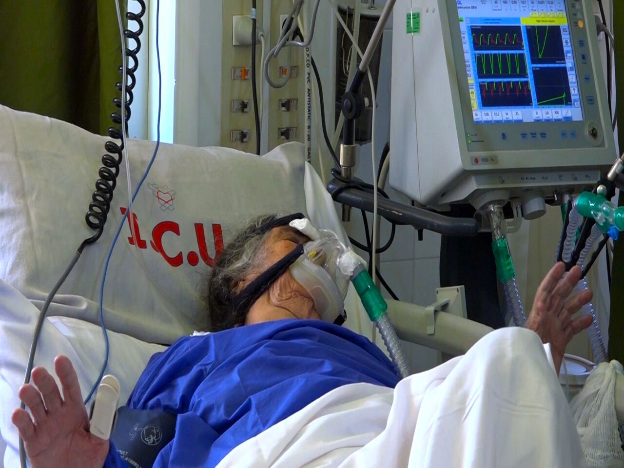 افزایش بیماران بستری مبتلا به کرونا در دزفول