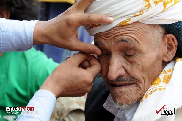 مراسم سرمه کشی در یمن
